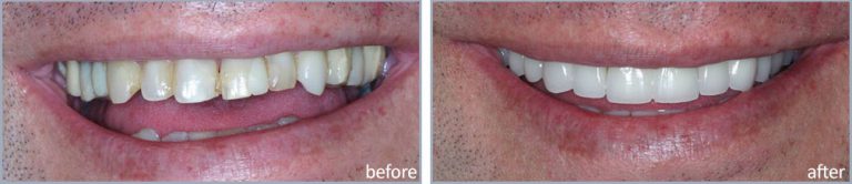 Ancient greece burial customs image