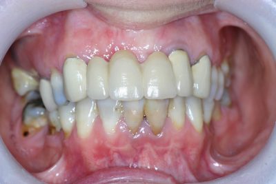 Teeth