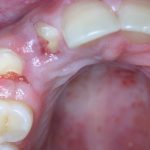 Teeth