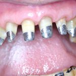 Teeth