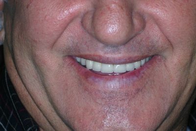 Teeth
