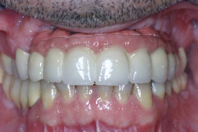 Teeth