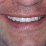 Teeth