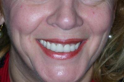 Teeth