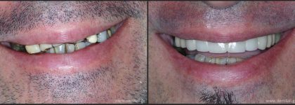 Dental repair