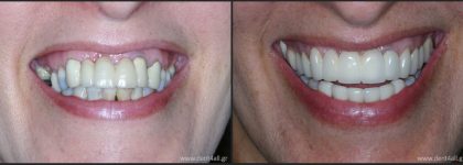 Dental repair