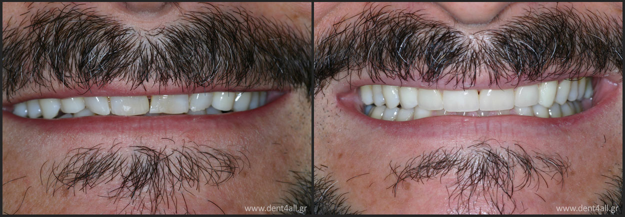 Dental repair